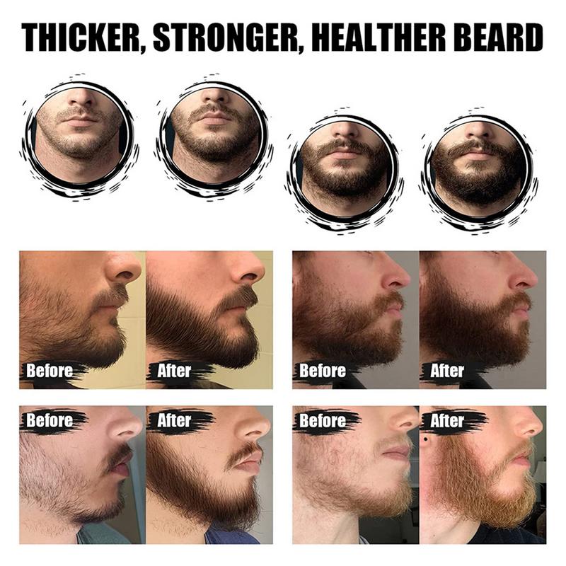 5 قطعة الرجال اللحية باربا الت - مراجعة Men'S Grooming Tonic وسعره